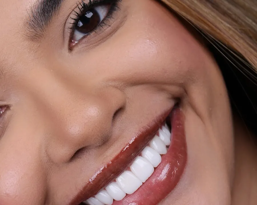 Sorriso feminino com lentes, vista aproximada